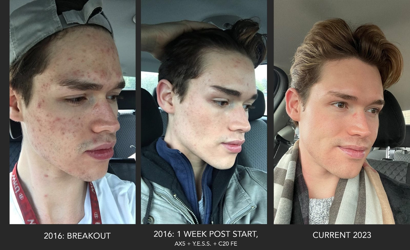 2016 breakout, one week after starting, and 2023