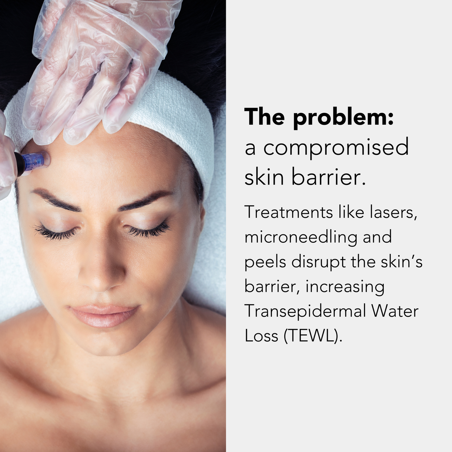 PHAZ - Post Microneedling Serum with Hyaluronic Acid Complex