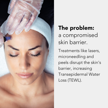 PHAZ - Post Microneedling Serum with Hyaluronic Acid Complex