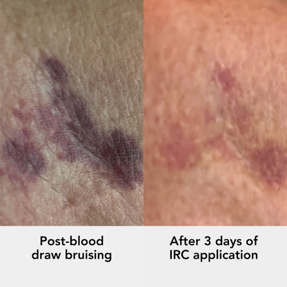 Intensive Recovery Complex