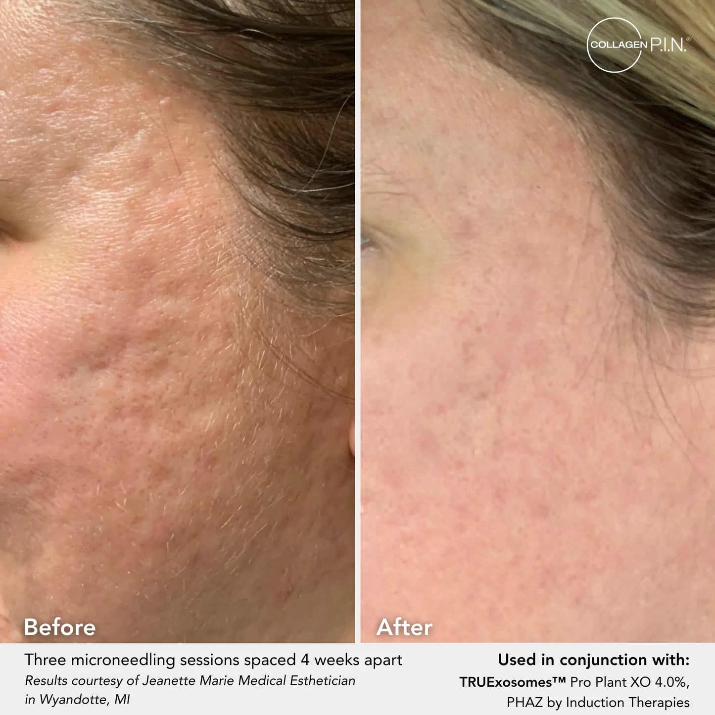 Pro Plant XO Plant Exosome + All-Trans Retinol Pads
